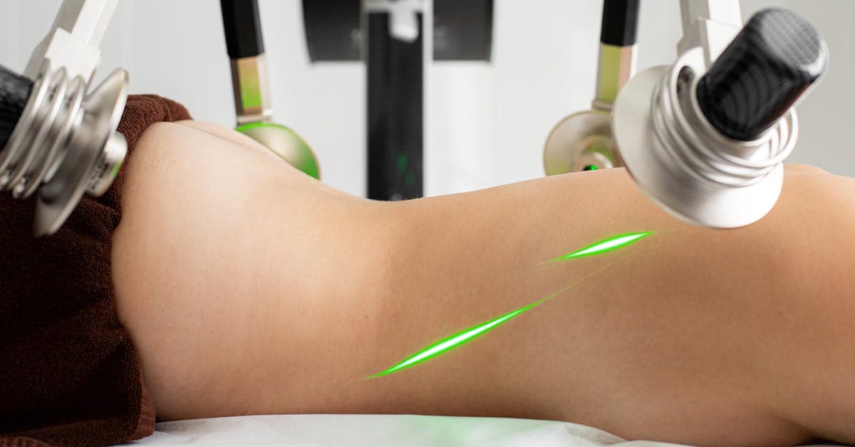 Cover Image for Transform Your Life: Exploring the Latest Weight Loss Procedures
